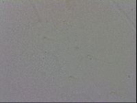 Mesobiotus coronatus image