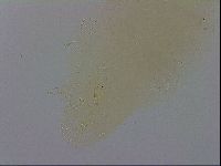 Mesobiotus coronatus image