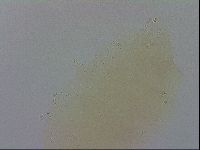 Mesobiotus coronatus image