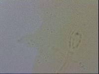 Mesobiotus coronatus image