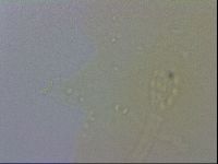 Mesobiotus coronatus image