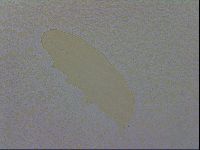 Mesobiotus coronatus image