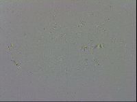 Mesobiotus coronatus image