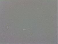 Mesobiotus coronatus image