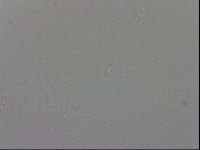 Mesobiotus coronatus image