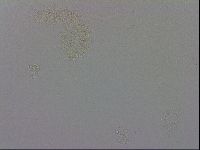 Mesobiotus coronatus image