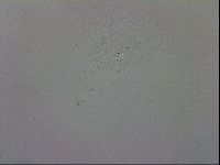 Mesobiotus coronatus image