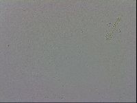 Mesobiotus coronatus image