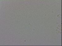 Mesobiotus coronatus image