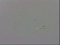 Mesobiotus coronatus image
