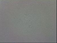 Mesobiotus coronatus image