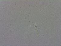 Mesobiotus coronatus image