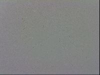 Mesobiotus coronatus image