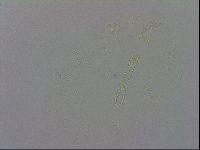 Mesobiotus coronatus image