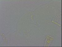 Mesobiotus coronatus image