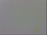 Mesobiotus coronatus image