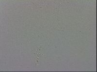 Mesobiotus coronatus image