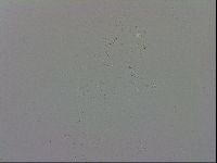 Mesobiotus coronatus image