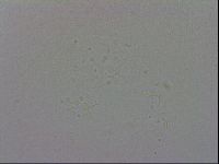 Mesobiotus coronatus image