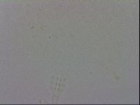 Mesobiotus coronatus image