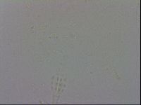 Mesobiotus coronatus image