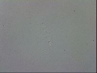 Mesobiotus coronatus image