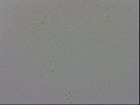 Mesobiotus coronatus image