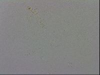 Mesobiotus coronatus image