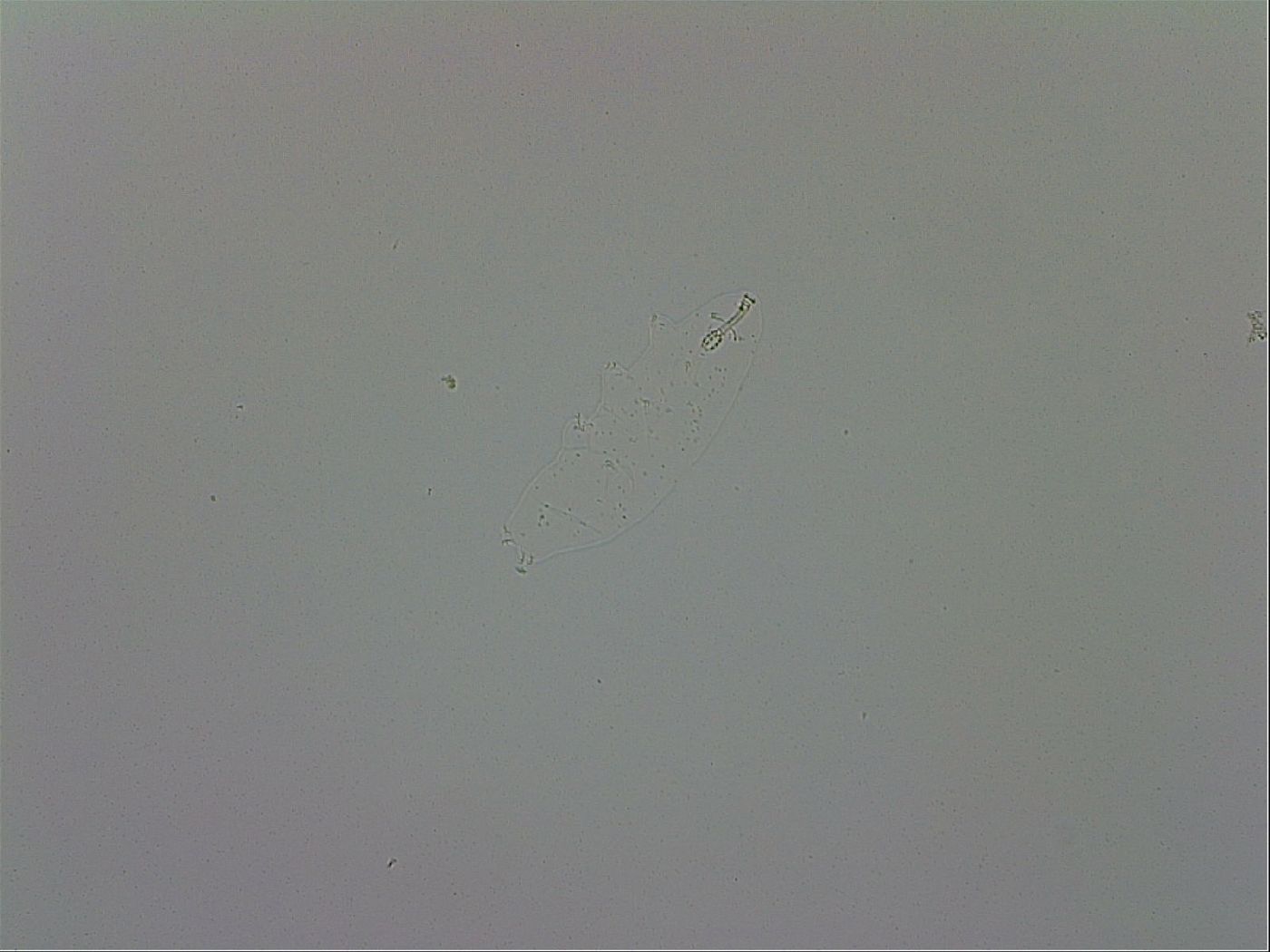 Mesobiotus coronatus image