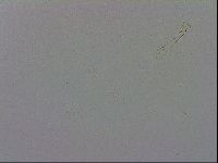 Mesobiotus coronatus image