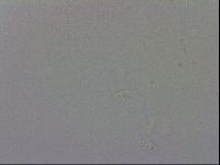Mesobiotus coronatus image
