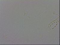 Mesobiotus coronatus image
