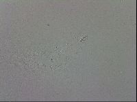 Mesobiotus coronatus image