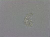Mesobiotus coronatus image