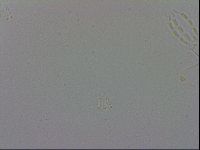 Mesobiotus coronatus image