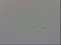 Mesobiotus coronatus image