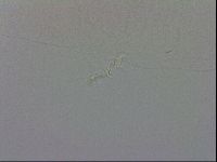 Mesobiotus coronatus image