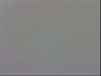 Mesobiotus coronatus image