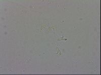 Mesobiotus coronatus image