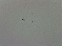 Mesobiotus coronatus image
