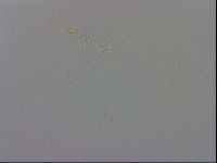 Mesobiotus coronatus image