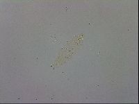 Mesobiotus coronatus image
