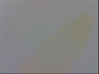 Mesobiotus coronatus image