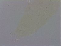 Mesobiotus coronatus image