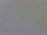 Mesobiotus coronatus image