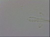 Mesobiotus coronatus image