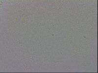 Mesobiotus coronatus image