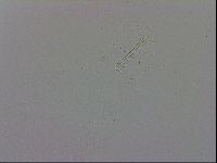 Mesobiotus coronatus image