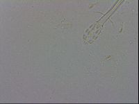 Mesobiotus coronatus image