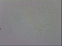 Mesobiotus coronatus image